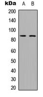 ADAM28 Antibody (Internal)