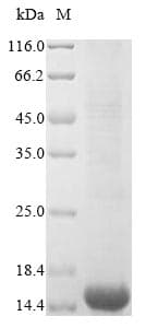 Human CD63 Protein (Recombinant 6His, N-terminus)