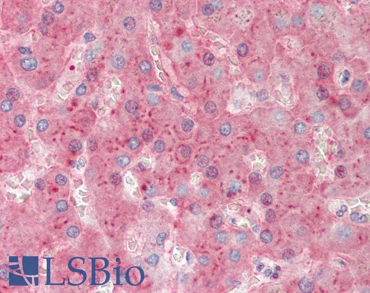 IHC-plus™ VTN / Vitronectin Antibody