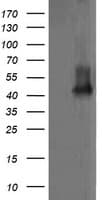 MAP2K1 / MKK1 / MEK1 Antibody (clone OTI3B4, Carrier-free)