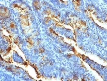 FSH Receptor / FSHR Antibody (clone FSHR/1400)