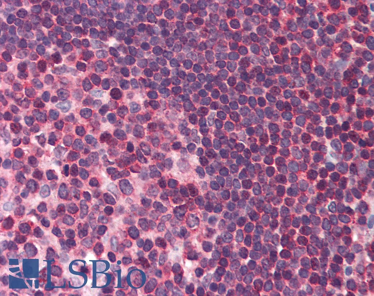 IHC-plus™ DAPK3 / ZIP Kinase Antibody