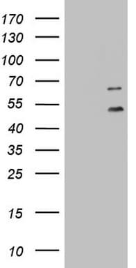 DDOST / OST48 Antibody (aa131-378, clone OTI2B4)
