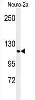 RERE Antibody (aa383-409)