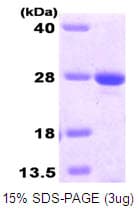 Human MGMT Protein (Recombinant His)
