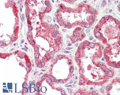 IHC-plus™ VSIR / GI24 / VISTA Antibody (aa37-194)