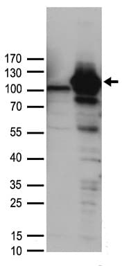 Polyclonal Rabbit anti-Human DDX58 / RIG-1 / RIG-I Antibody (WB)