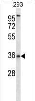 Polyclonal Rabbit anti-Human P2RY6 / P2Y6 Antibody (aa286-314, WB)