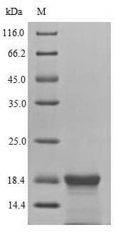 Epstein-Barr Virus LMP2 Protein (Recombinant 6His-SUMO, N-terminus)