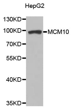 Polyclonal Rabbit anti-Human MCM10 Antibody (WB)