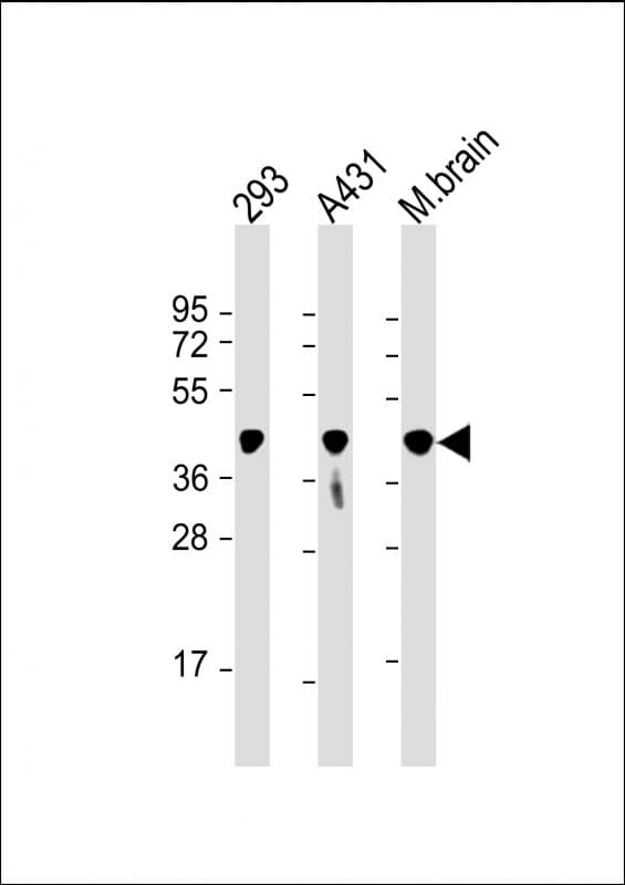 PGK1 / Phosphoglycerate Kinase Antibody (clone 1086CT10.2.1)