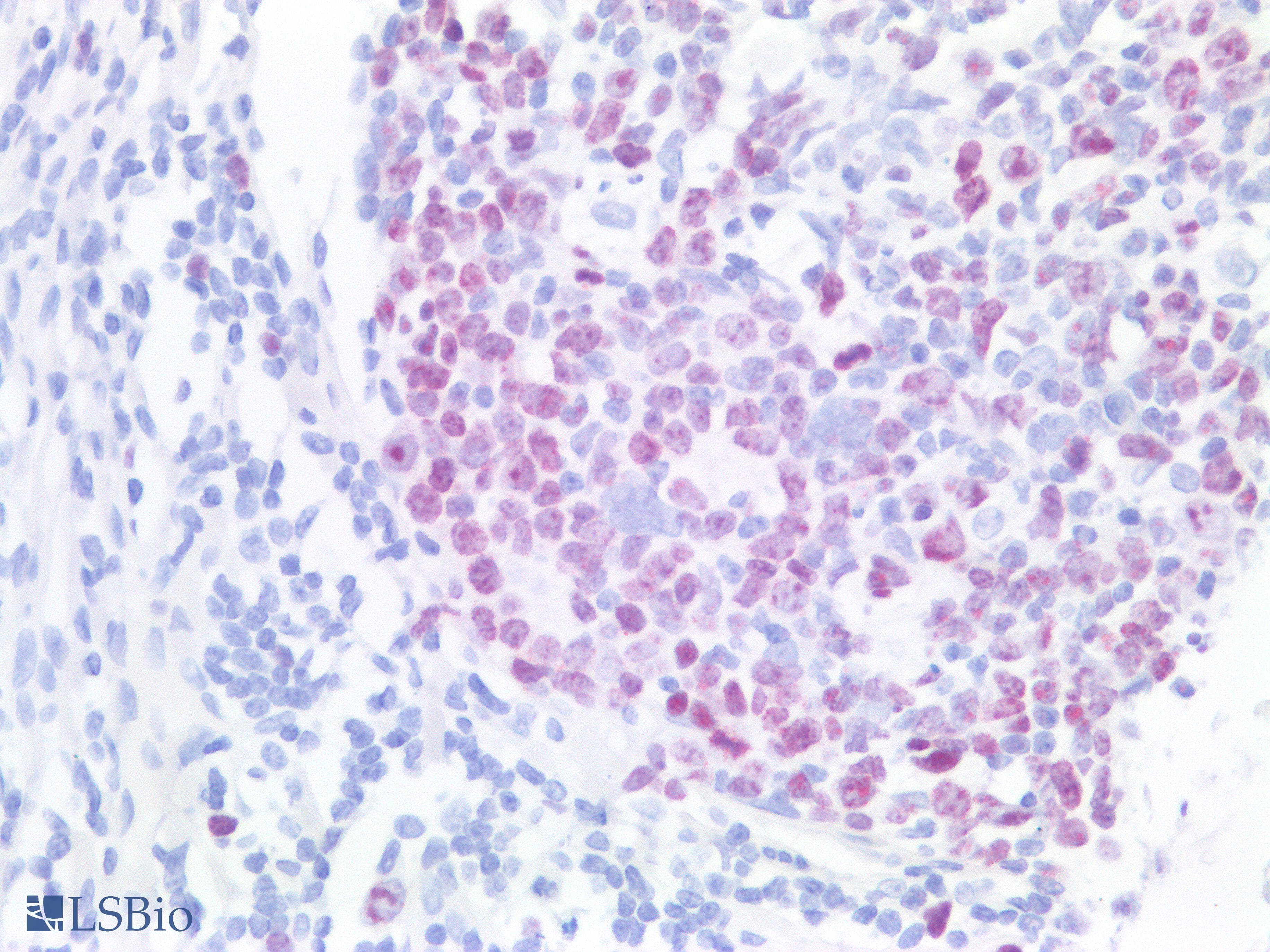 PathPlus™ MKI67 / Ki67 Antibody (clone AHC0157)