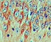 Polyclonal Rabbit anti-Human FGF20 Antibody (aa100-150, IHC)