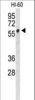 PV1 / PLVAP Antibody (aa214-242)