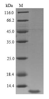 Human IGF1 Protein (Recombinant 6His, N-terminus)