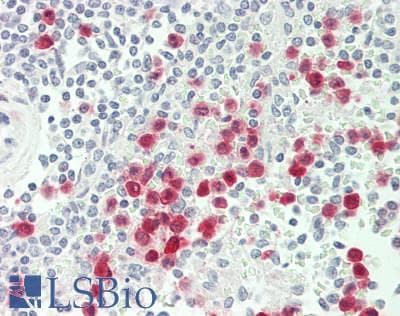 IHC-plus™ S100A12 Antibody (clone 1D1)