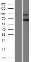 CCDC178 / C18orf34 Protein (Over-Expression Lysate Myc-DDK (Flag))