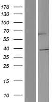 TRIM5 Protein (Over-Expression Lysate Myc-DDK (Flag))