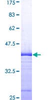 Human GP78 / AMFR Protein (Recombinant GST, N-terminus)