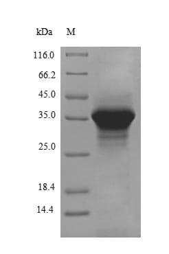 Rabbit APOE / Apolipoprotein E (Recombinant 10His, N-terminus + Myc, C-terminus)