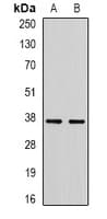Polyclonal Rabbit anti-Human RBFOX3 / NEUN Antibody (IHC, IF, WB)