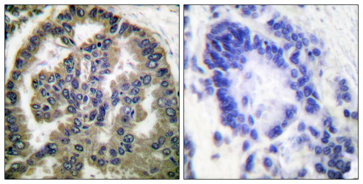 TGFB2 / TGF Beta2 Antibody