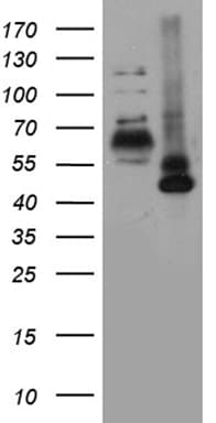 RORA / ROR Alpha Antibody (aa98-345, clone OTI5A6)
