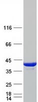 Human TPM3 Protein (Recombinant Myc-DDK (Flag))