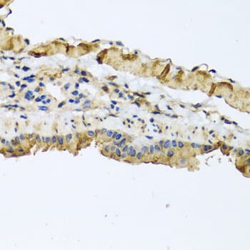 Polyclonal Rabbit anti-Human ATP2C1 Antibody (IHC, WB)