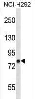 MMP9 / Gelatinase B Antibody (aa549-578)