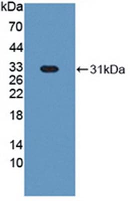 GC1qR / C1QBP Antibody (aa71-278)