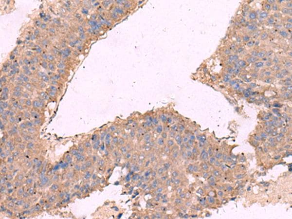KCNN3 / SK3 Antibody