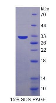 Mouse PRKDC / DNA-PKcs Protein (Recombinant His-T7)