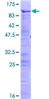 Human MECP2 Protein (Recombinant GST)