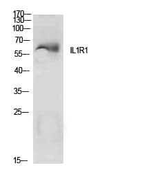 Polyclonal Rabbit anti-Human IL1R1 Antibody (WB)