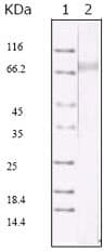 HHV-8 ORF45 Antibody (clone 2D4A5)