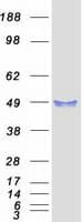 Human TMX4 Protein (Recombinant Myc-DDK (Flag))