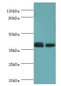 TREX1 Antibody (aa1-270)