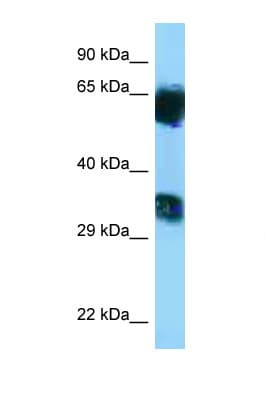 MGAT5B Antibody (aa362-411)