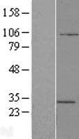 ATP6V1E2 Protein (Over-Expression Lysate Myc-DDK (Flag))