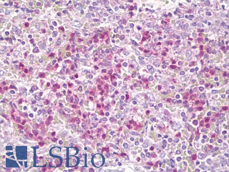 IHC-plus™ Polyclonal Rabbit anti-Human CSF2RB / CD131 Antibody (aa559-608, IHC, WB)