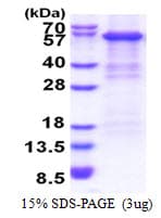 Human CFB / Complement Factor B Protein (Recombinant His)