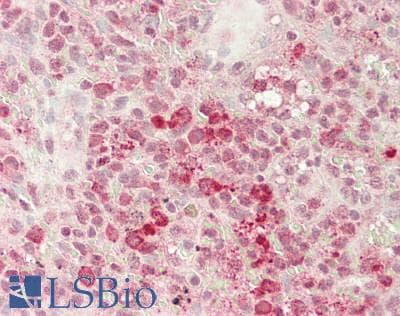 IHC-plus™ TGFB1 / TGF Beta 1 Antibody (aa 281-390)