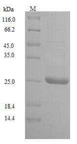 Human UL128 Protein (Recombinant 6His, N-terminus)