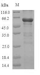 Mouse CBS Protein (Recombinant 6His, N-terminus)