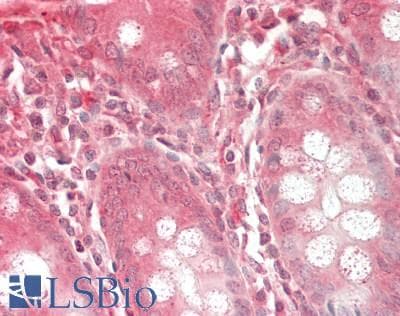 IHC-plus™ CRABP1 / CRABP Antibody