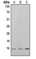 EIF4EBP1 / 4EBP1 Antibody (phospho-Thr46)