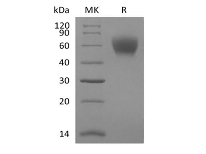 Mouse TPBG / 5T4 Protein (Recombinant 6His, C-terminus)