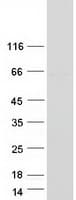 Human POC5 Protein (Recombinant Myc-DDK (Flag))