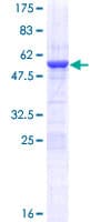 Human HMG1 / HMGB1 Protein (Recombinant GST)